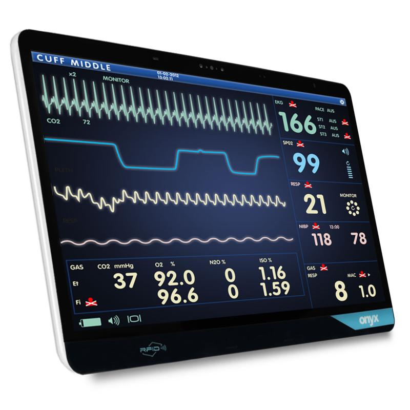 Onyx VENUS-224, 22", i5-1135G7, 256GB SSD, 16GB RAM, Wifi, RFID, 2x XL Akku, Orion Lizenz Onyx VENUS-224, 22", i5-1135G7, 256GB SSD, 16GB RAM, Wifi, RFID, 2x XL Akku, Orion Lizenz