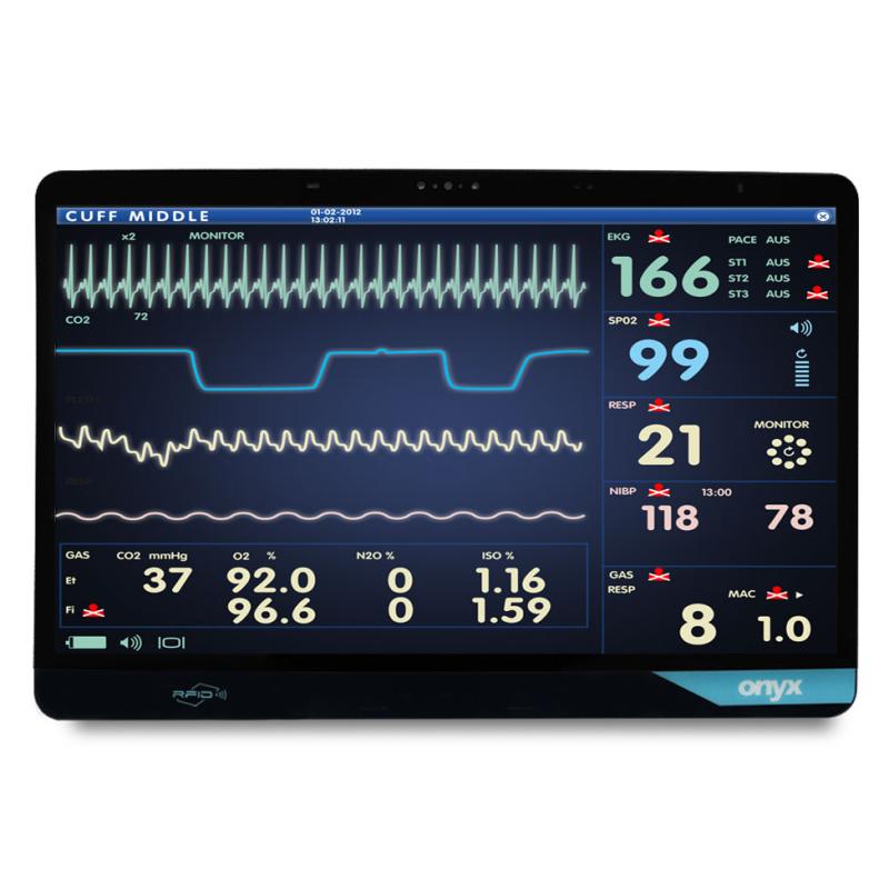 Onyx VENUS-224, 22", i5-1135G7, 256GB SSD, 16GB RAM, Wifi, RFID, 2x XL Akku, Orion Lizenz Onyx VENUS-224, 22", i5-1135G7, 256GB SSD, 16GB RAM, Wifi, RFID, 2x XL Akku, Orion Lizenz