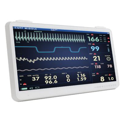 Medico 27T 27'' Medical Panel PC, i5-13600HE, 16GB, 256GB, internes NT, lüfterlos, Wifi Medico 27T 27'' Medical Panel PC, i5-13600HE, 16GB, 256GB, internes NT, lüfterlos, Wifi